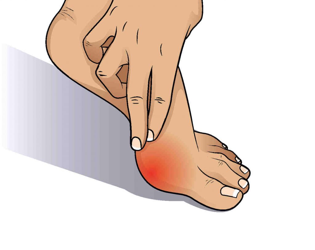 Bunion Therapy And Treatment - Foot and Ankle Podiatrists