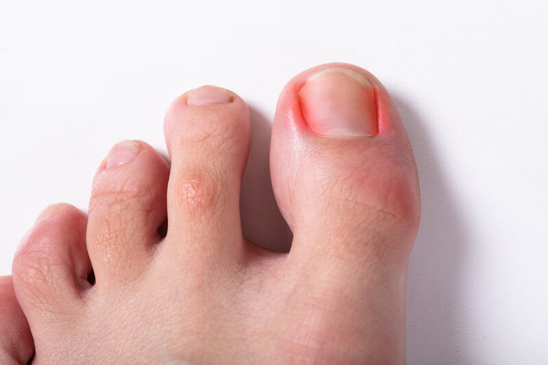Causes of Stabbing Foot Pain: Town Center Foot & Ankle: Podiatry